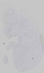 EMAGE:16572