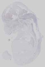 EMAGE:16577