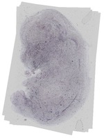 EMAGE:16579