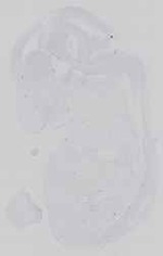 EMAGE:16581