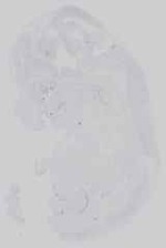 EMAGE:16581