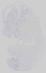 EMAGE:16581