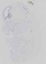 EMAGE:16584