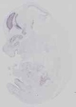 EMAGE:16584