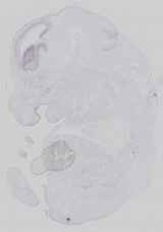 EMAGE:16584