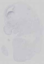 EMAGE:16584