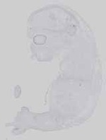 EMAGE:16584