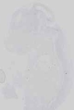 EMAGE:16613