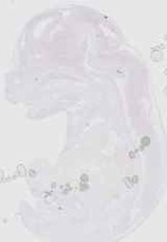 EMAGE:16615