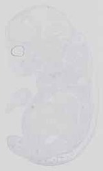 EMAGE:16643