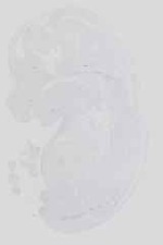 EMAGE:16644