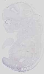 EMAGE:16646