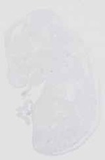 EMAGE:16651