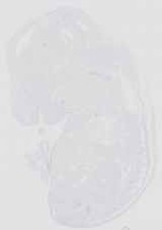 EMAGE:16651