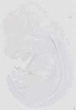 EMAGE:16651