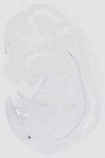 EMAGE:16653