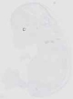 EMAGE:16653