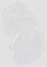 EMAGE:16654