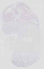EMAGE:16657
