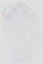 EMAGE:16657