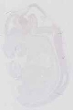 EMAGE:16657