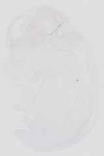 EMAGE:16657