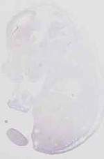 EMAGE:16657