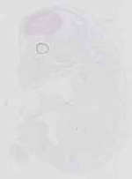 EMAGE:16657