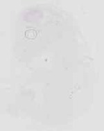 EMAGE:16657