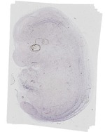 EMAGE:16657