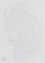 EMAGE:16659