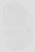 EMAGE:16659