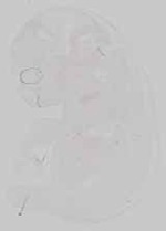 EMAGE:16665
