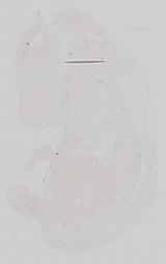 EMAGE:16676