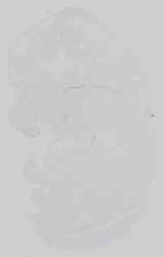 EMAGE:16683