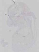 EMAGE:16693
