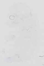 EMAGE:16710