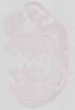 EMAGE:16713