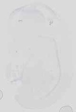 EMAGE:16719
