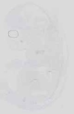 EMAGE:16721