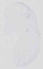 EMAGE:16734