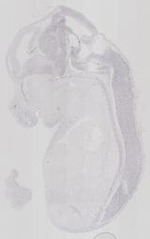 EMAGE:16737