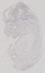 EMAGE:16737