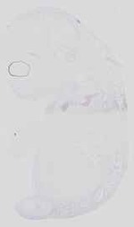 EMAGE:16738