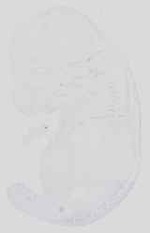 EMAGE:16738
