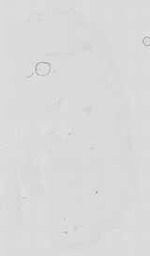 EMAGE:16738