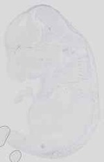 EMAGE:16739