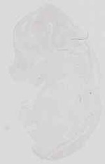 EMAGE:16739