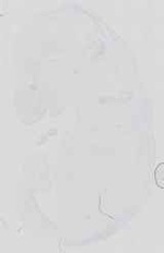EMAGE:16739