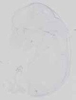 EMAGE:16741